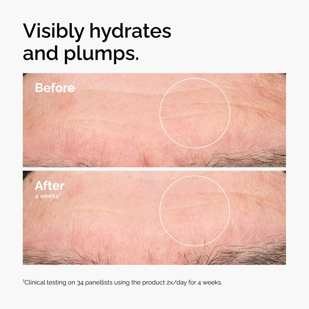 The Ordinary Hyaluronic Acid 2% + B5 (with Ceramides), Multi-Depth Hydration Serum for Plumper, Smoother Skin Jansha Store