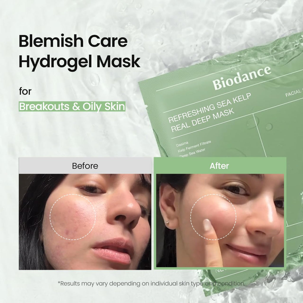BIODANCE Bio-Collagen Real Deep Mask, Hydrating Overnight Hydrogel Face Mask, Pore Minimizing, Elasticity, Plumping, Travel Essentials & Self Care Gifts for Women, Korean Skin Care | 1.19oz(34g) x 4ea Jansha Store