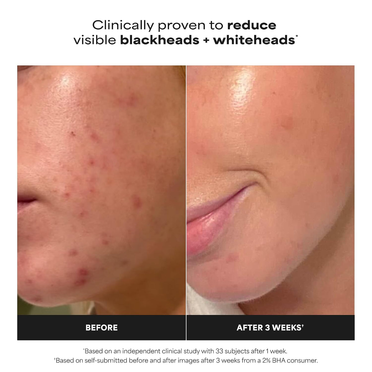 Paula's Choice SKIN PERFECTING 2% BHA Liquid Leave-On Exfoliant Jansha Store