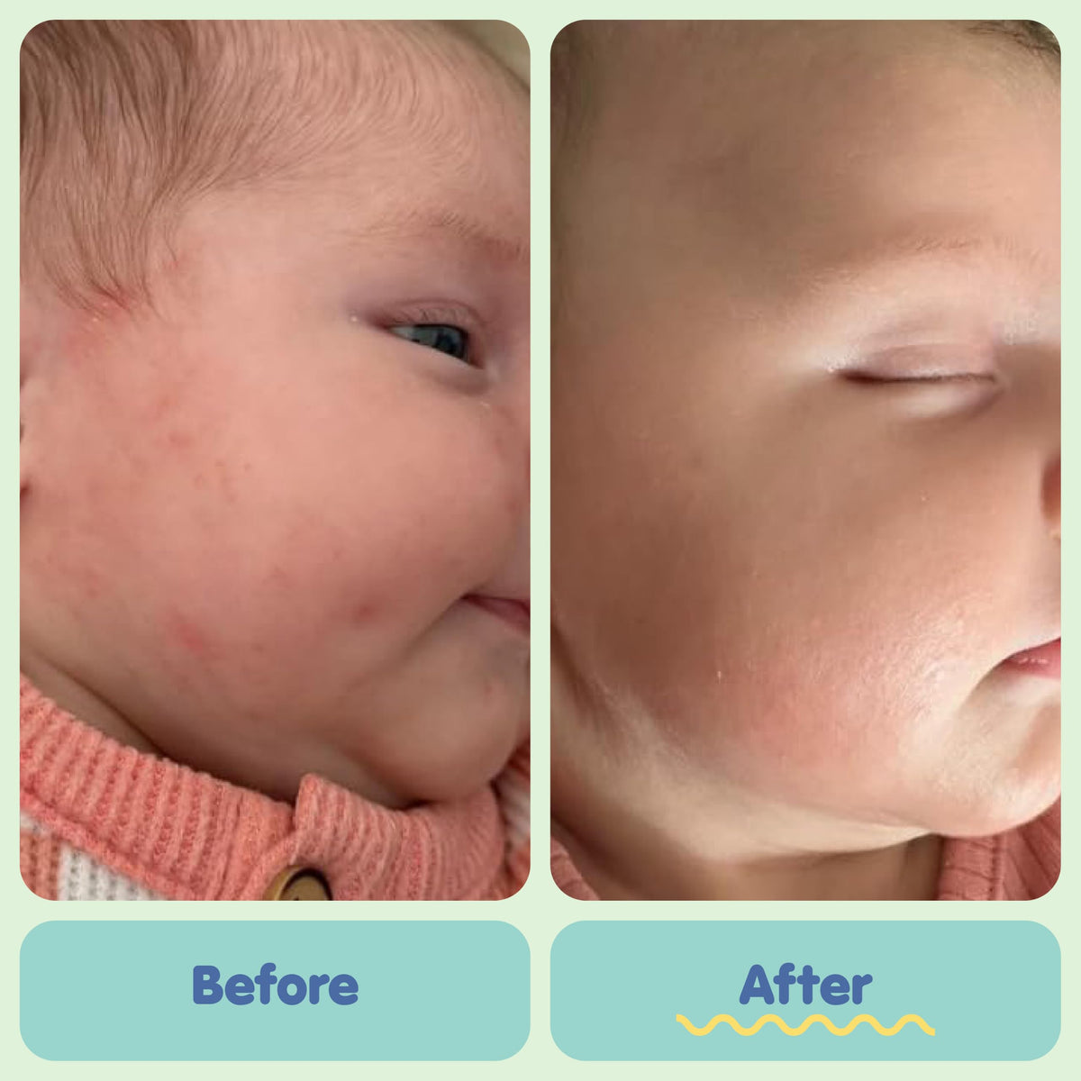 Tubby Todd All Over Ointment, Baby Eczema Cream for Sensitive Skin Jansha Store