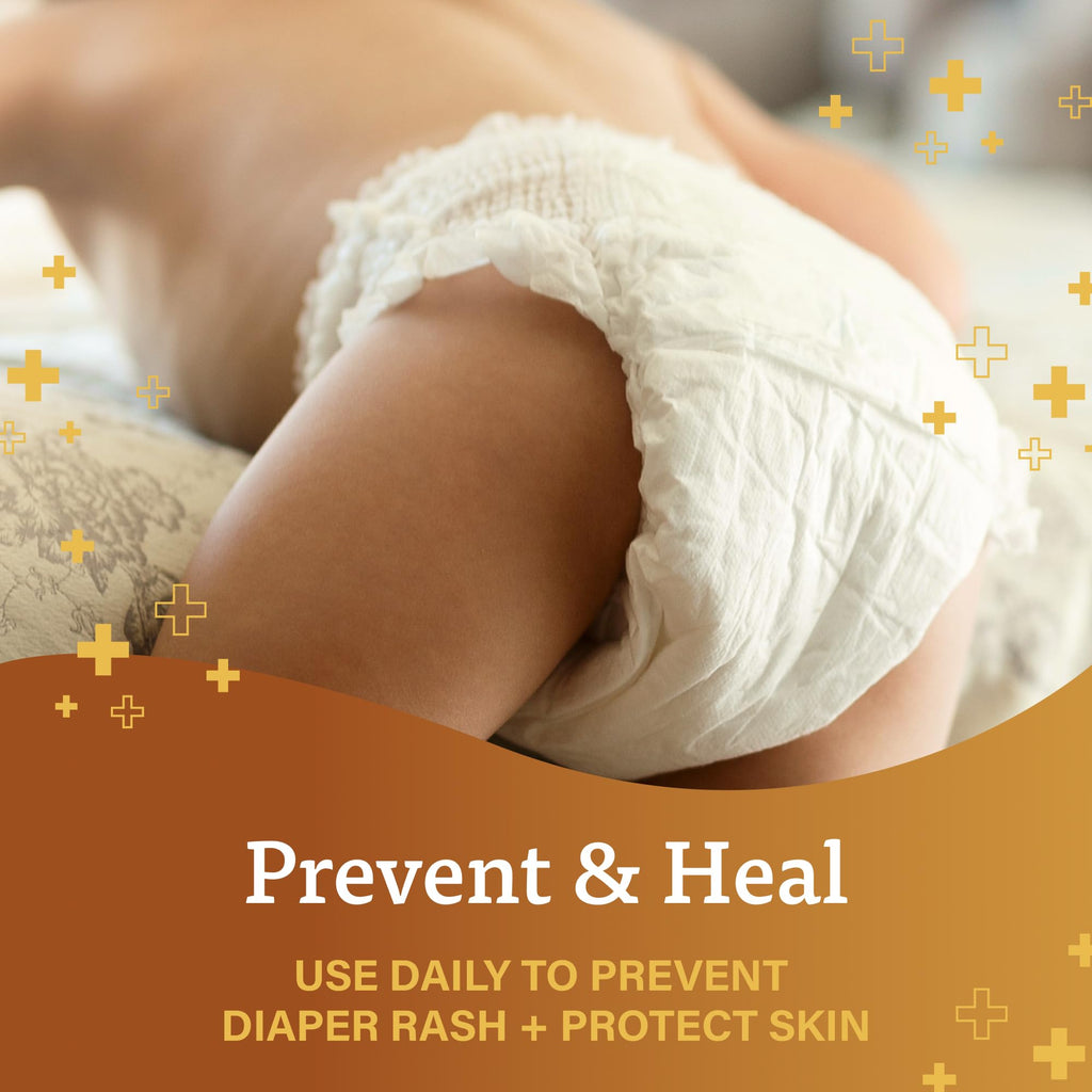A+D Prevent + Heal Diaper Rash Ointment, With Vitamins A & D - 4 oz Tube Jansha Store