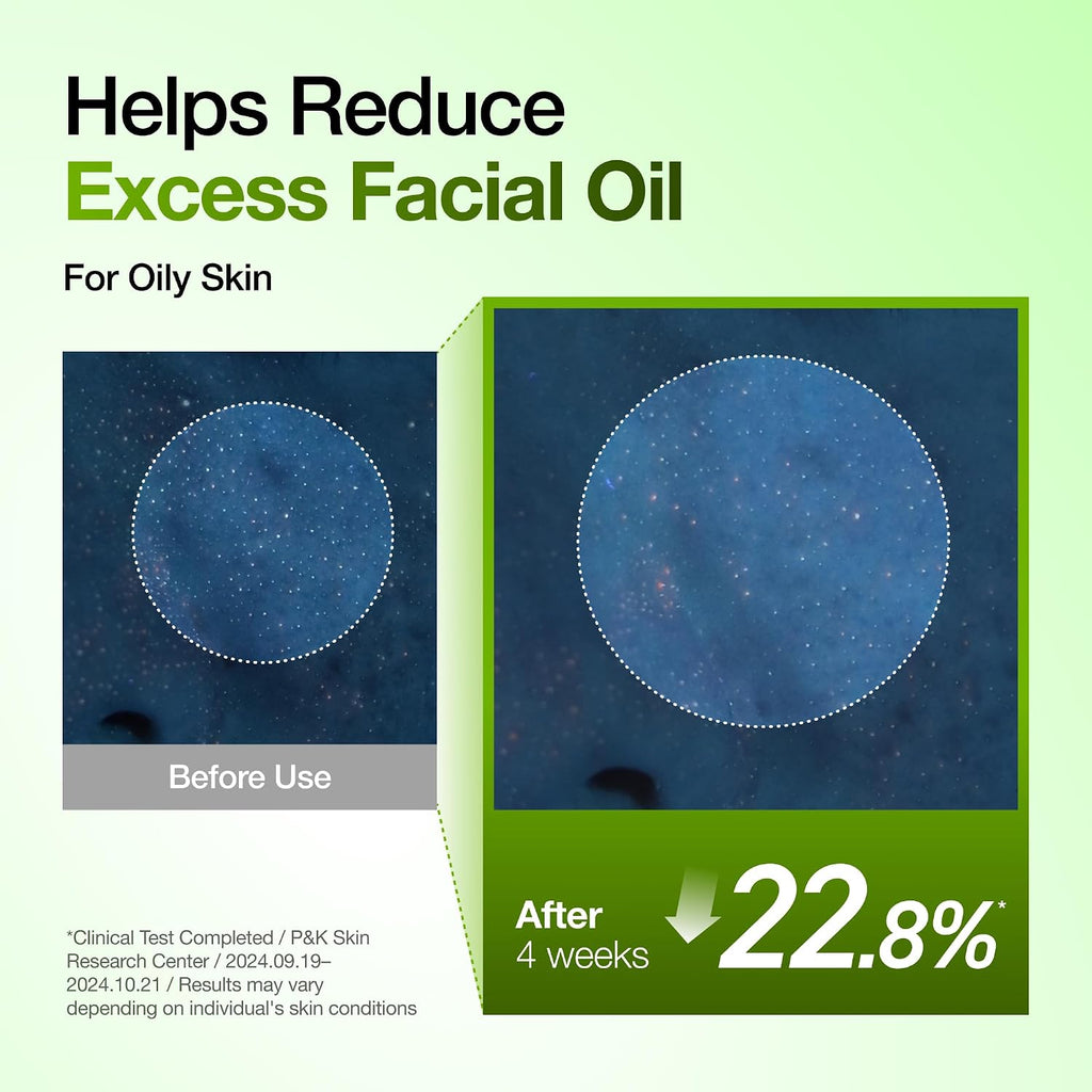 Anua Azelaic Acid 10 Hyaluron Redness Soothing Serum, 1.01 fl oz Jansha Store
