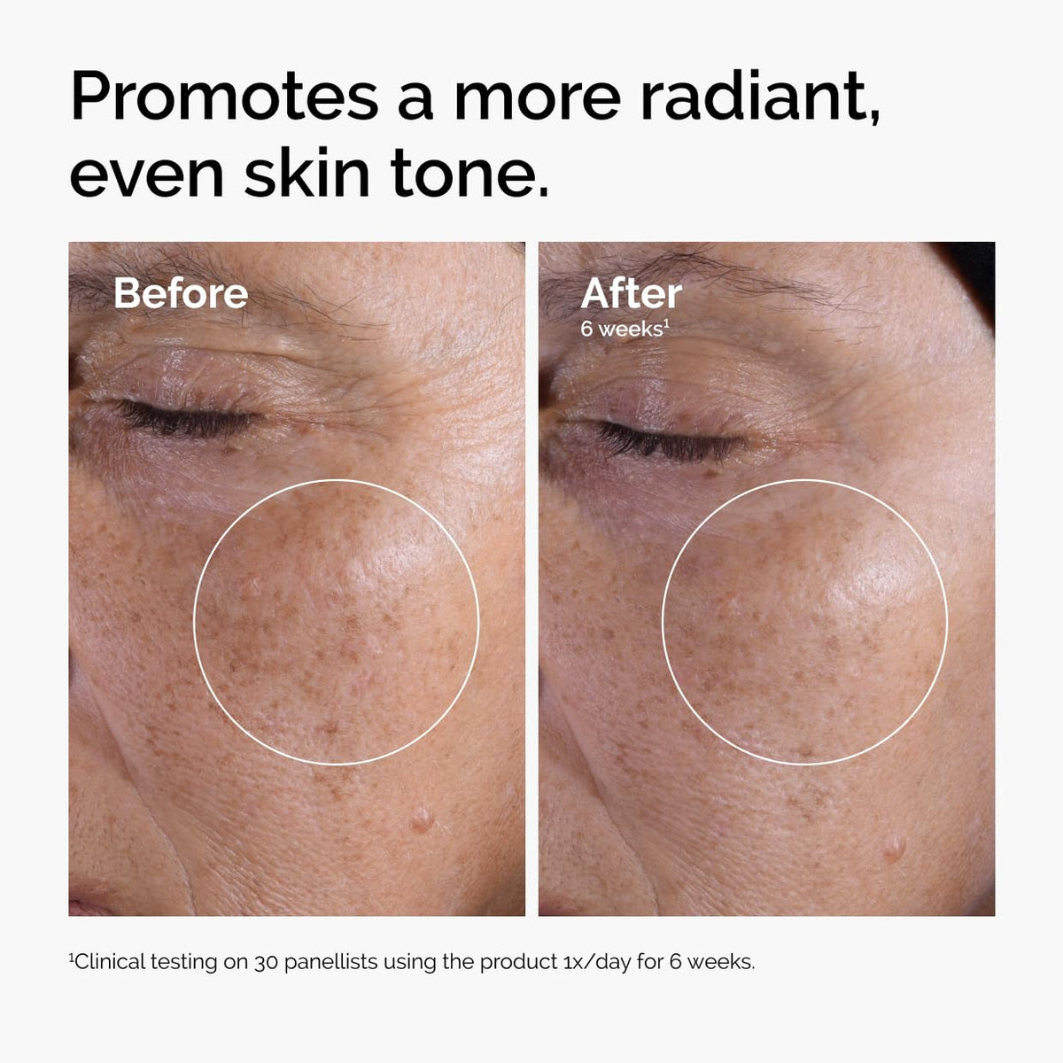 The Ordinary Glycolic Acid 7% Exfoliating Toner, Brightening and Smoothing Daily Toner for More Even-Looking Skin Tone Jansha Store