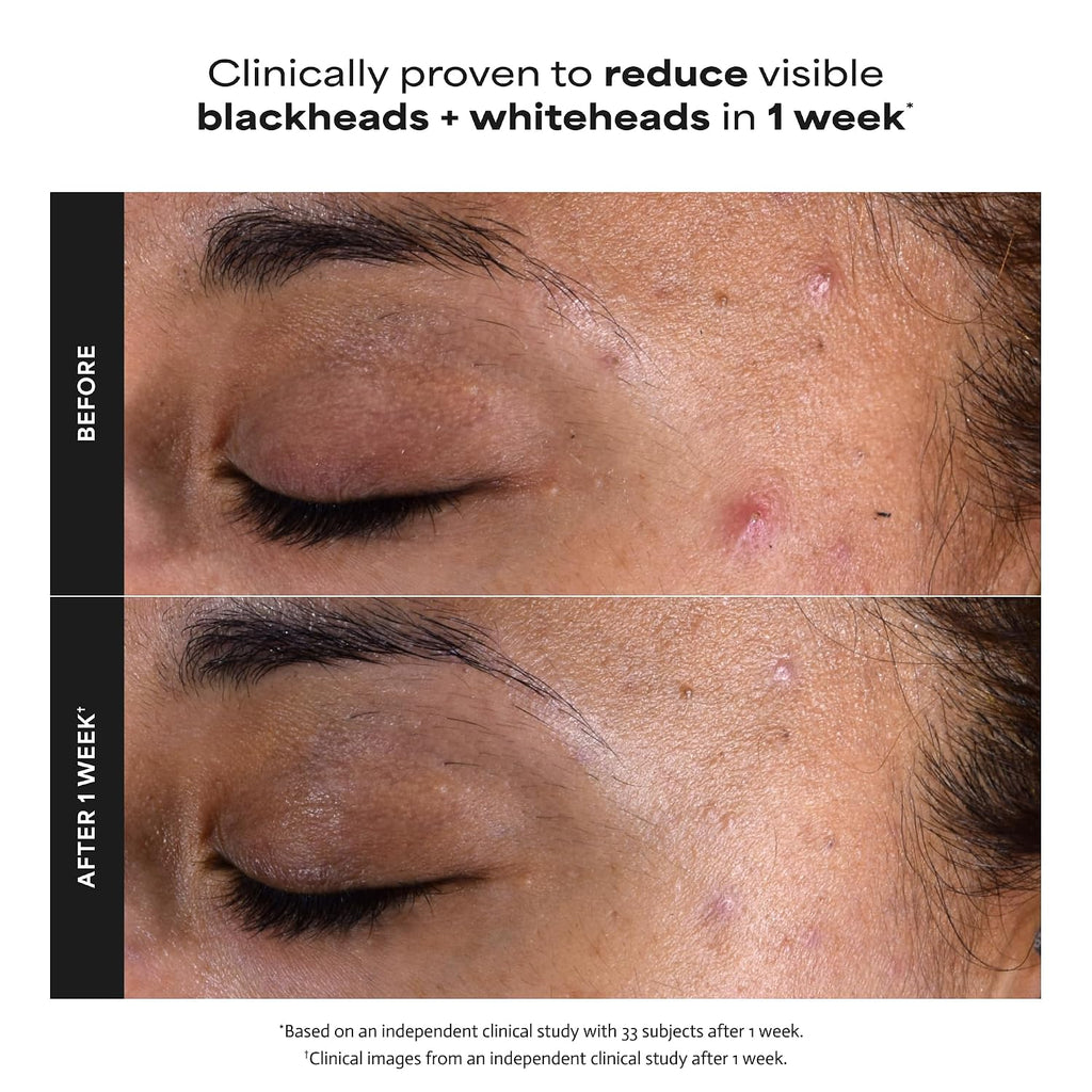 Paula's Choice SKIN PERFECTING 2% BHA Liquid Leave-On Exfoliant Jansha Store