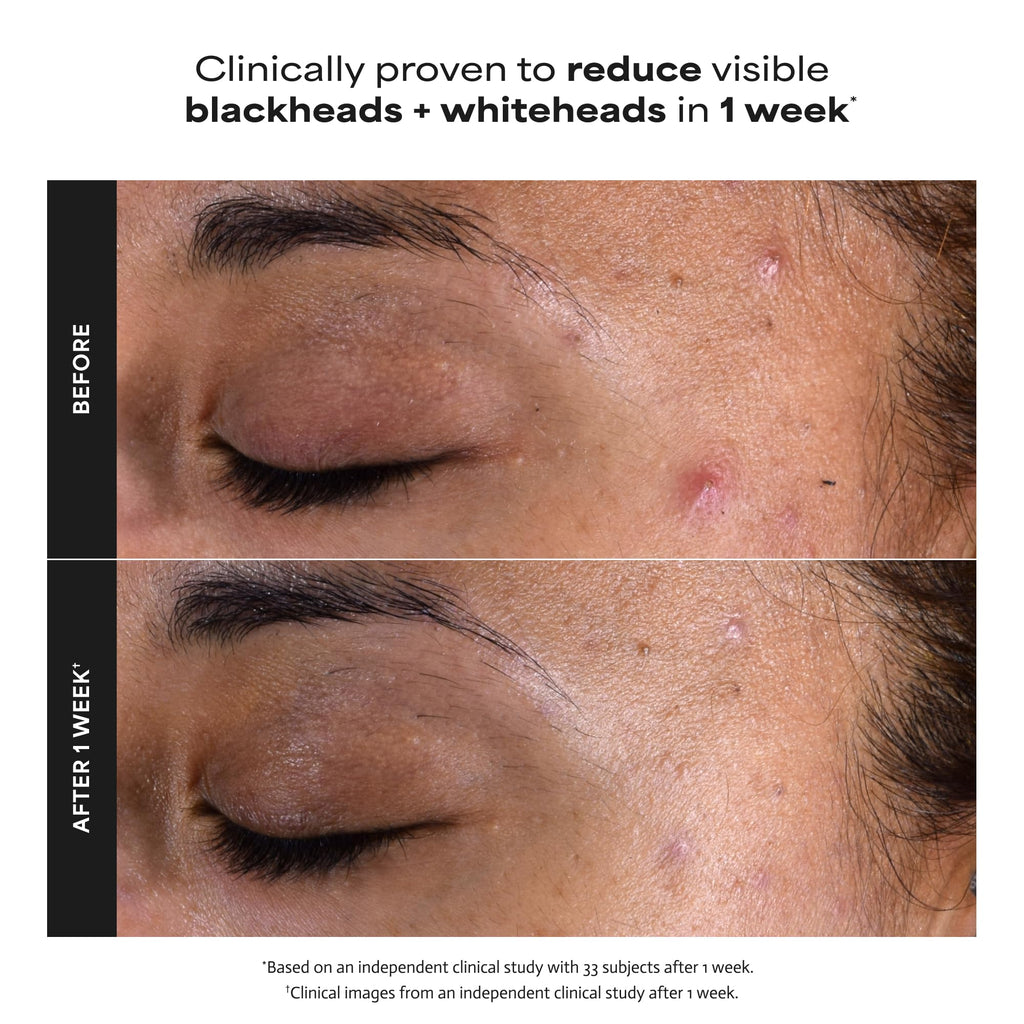 Paula's Choice SKIN PERFECTING 2% BHA Liquid Leave-On Exfoliant Jansha Store