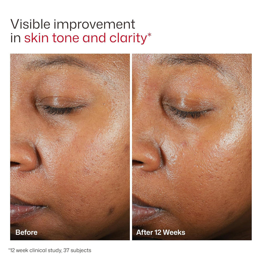 EltaMD UV Clear Face Sunscreen with Zinc Oxide, Oil-Free, SPF 46 and SPF 50 Jansha Store