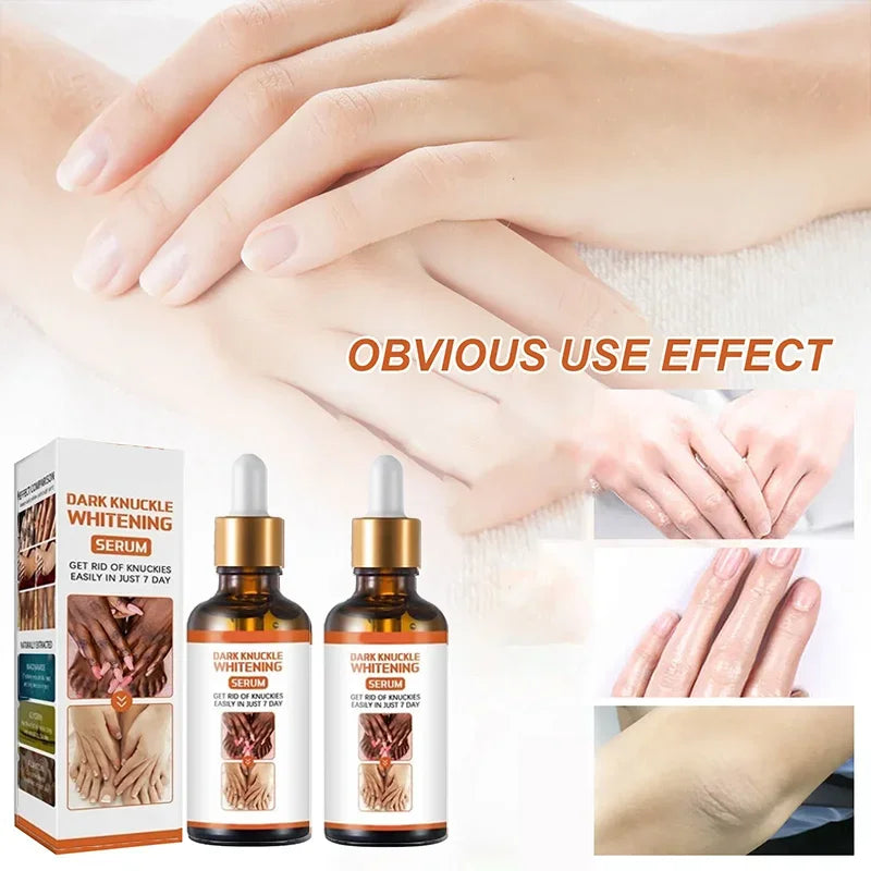 Skin Whitening Cream Cashymart