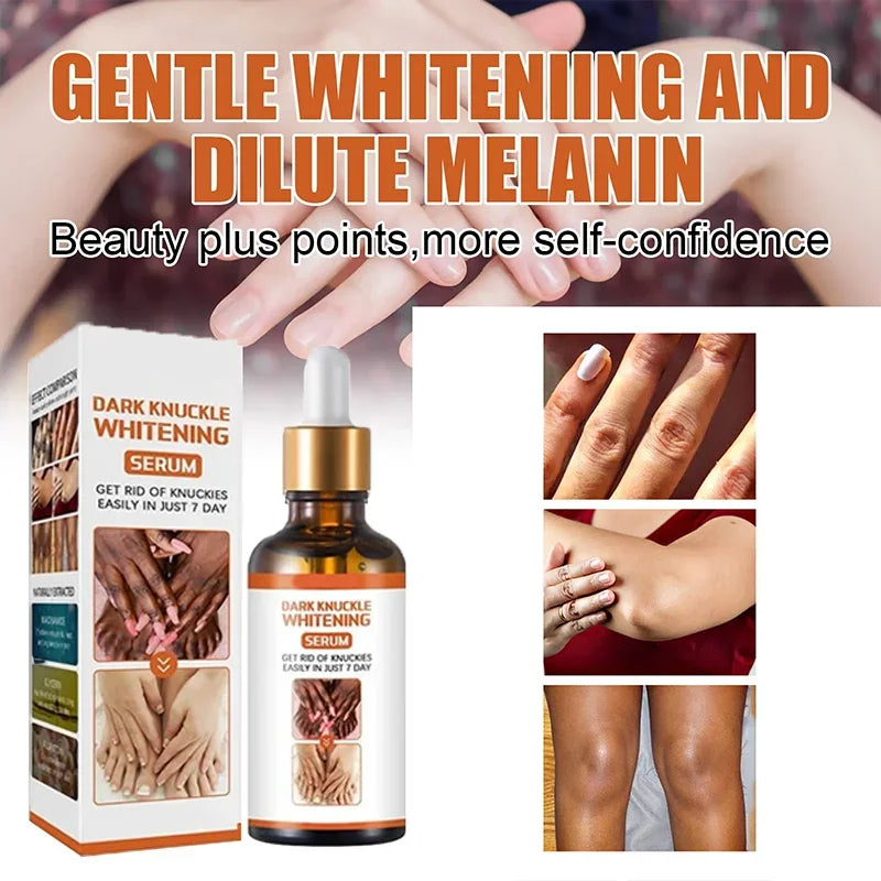 Skin Whitening Cream Cashymart